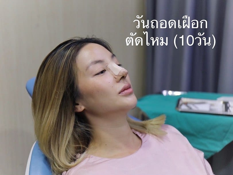 ฮารุ อวดจมูกใหม่