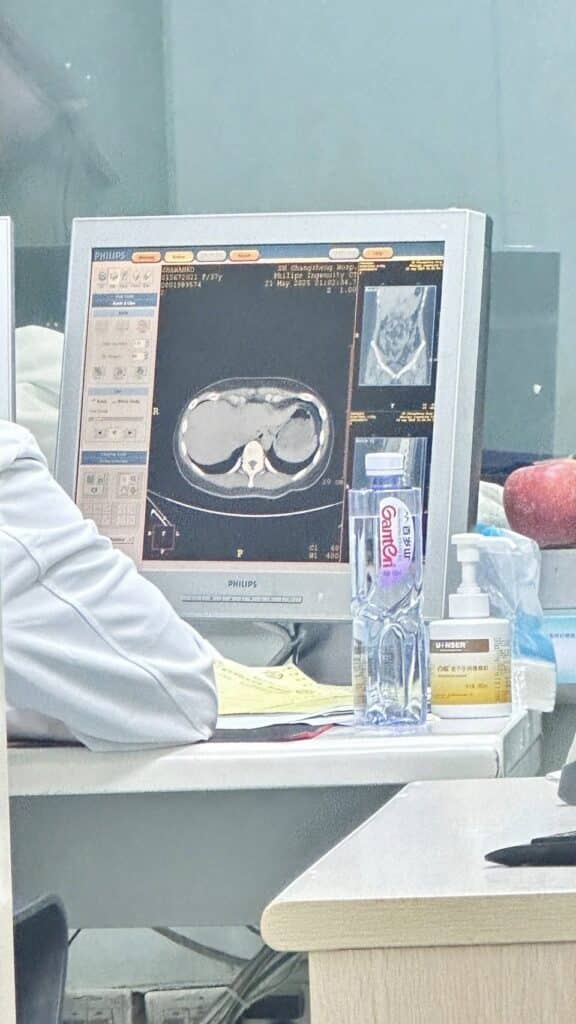 กระติ๊บ ปวดท้อง