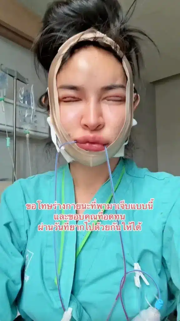 นัท นิสามณี ขึ้นเขียง