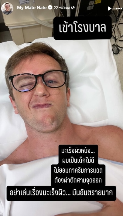 เนท My Mate Nate แจ้ง