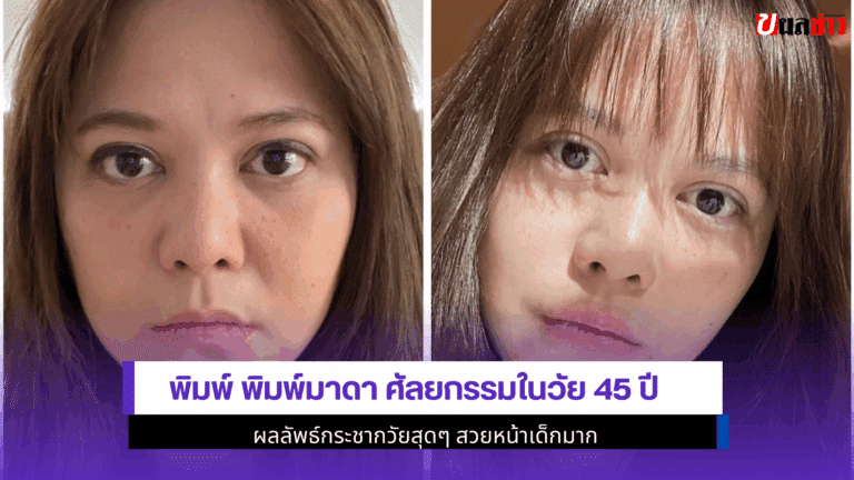 พิมพ์ พิมพ์มาดาศัลยกรรม