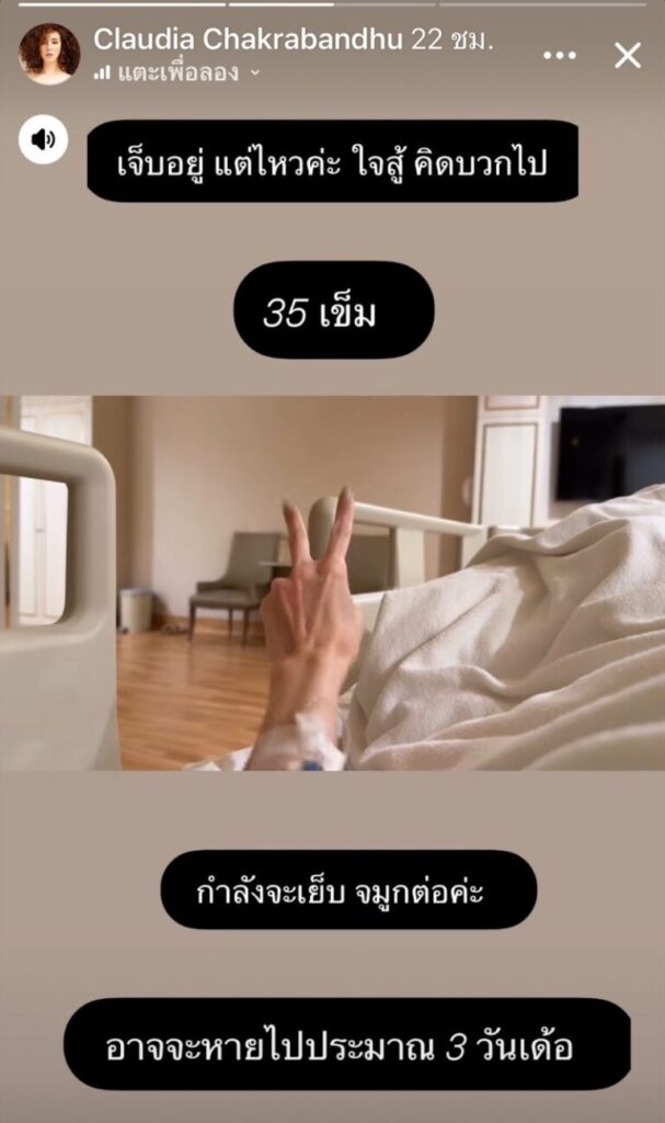 คลาวเดีย วูบล้มหัวฟาด