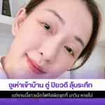 งูเห่าเข้าบ้าน ตู่