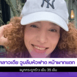 คลาวเดีย วูบล้มหัวฟาด