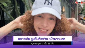คลาวเดีย วูบล้มหัวฟาด