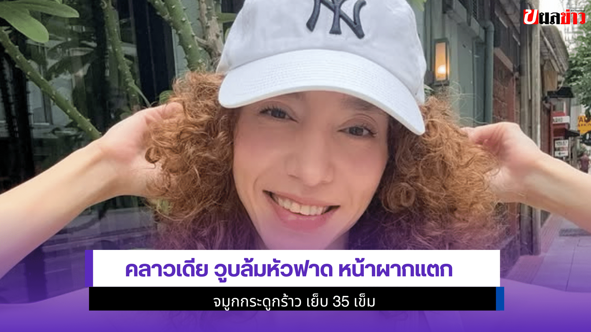 คลาวเดีย วูบล้มหัวฟาด