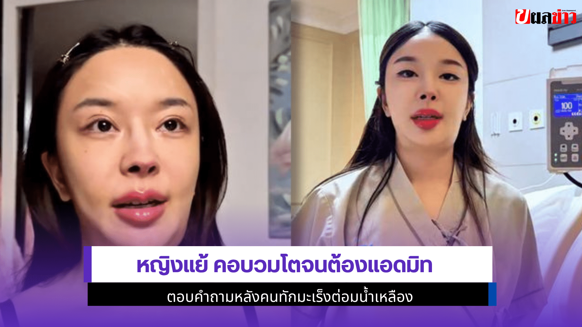 หญิงแย้ คอบวม