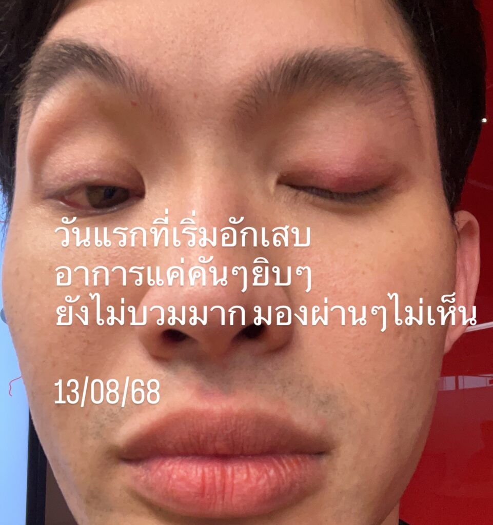 ดีเจมะตูม แชร์อุทาหรณ์