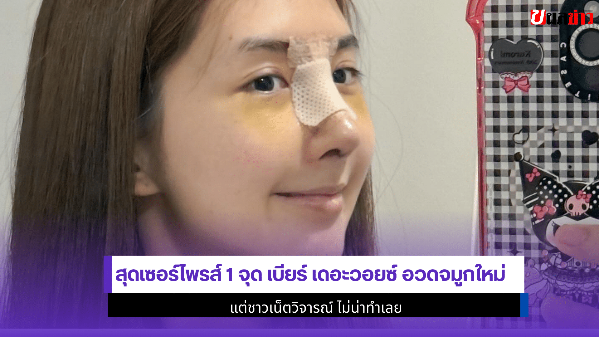 เบียร์ เดอะวอยซ์