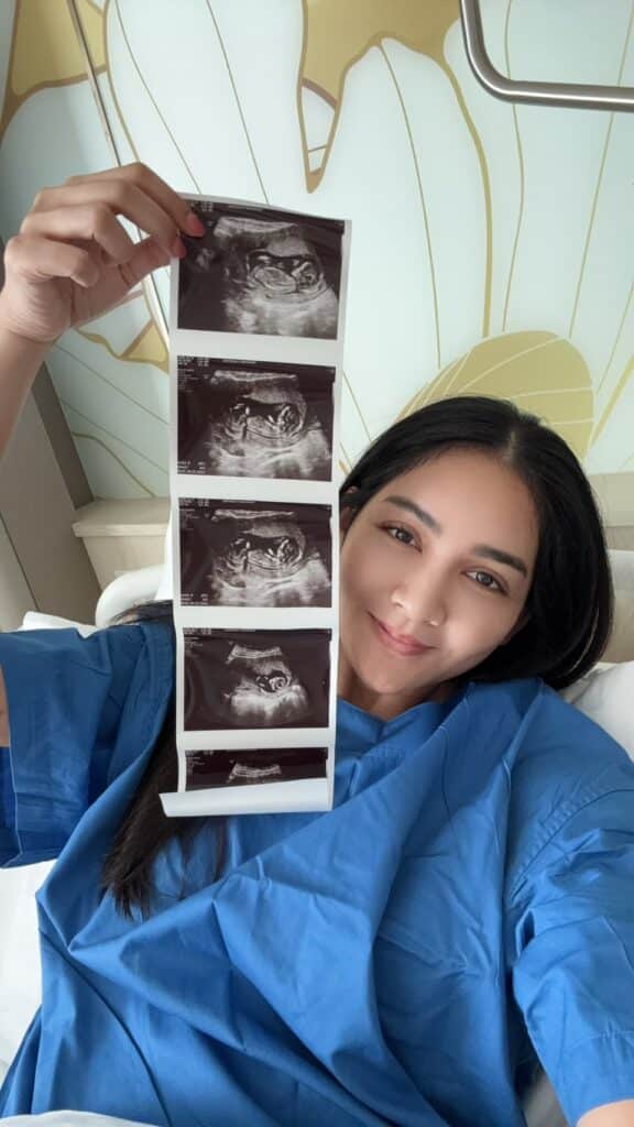 ครูก้อย ภรรยา เจมส์