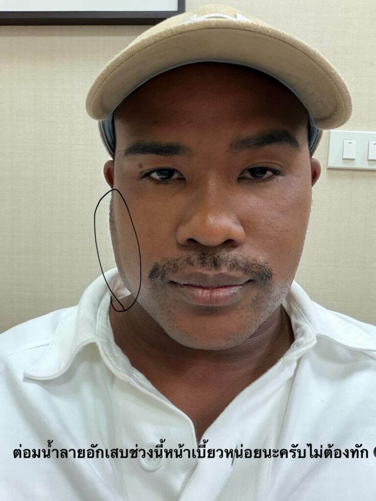 รัศมีแข