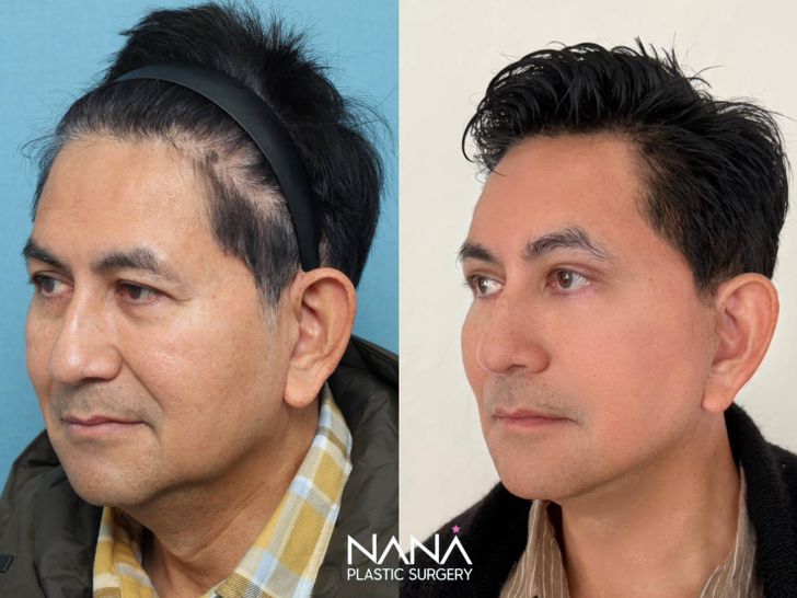 ดุ๊ก ภาณุเดช
