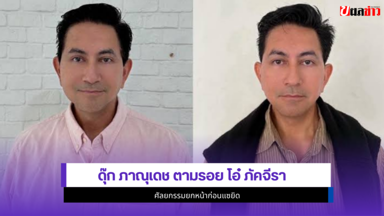 ดุ๊ก ภาณุเดช ศัลยกรรมยกหน้าก่อนแซยิด หน้าเด็กลง 10 ปี