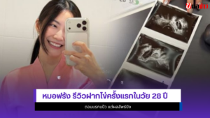 หมอฟรัง